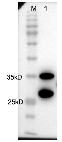 Western Blot 检测蛋白表达