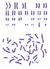 染色体核型分析服务