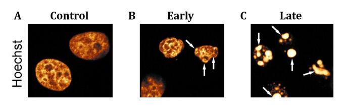 Hoechst染色显示Hela细胞凋亡过程中核染色质变化