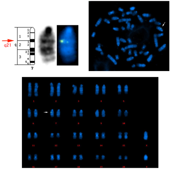  检测大鼠转入基因的染色体定位。如图所示，外源基因位于大鼠染7号染色体的q21区域。